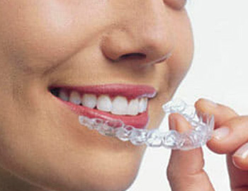 Best Dental Hospitals in Guntur,Best Dental Hospital in Guntur,Best Dental Doctor in Guntur,Best Dental Doctors in Guntur,Best Dental Clinic in Guntur,Best Dental Clinics in Guntur,Famous Dental Hospitla in guntur,Famous dental hospitals in guntur,Best Dental clinic near me,Best Evening Hospitals in Guntur,Best Orthodontist in guntur,Braces Treatment in Guntur,Best Dentist in Guntur,Best Dentists in Guntur,Best Habit breaking appliance treatment in Guntur,Hygienic dental Hospital in Guntur,Hygienic dental Hospitals in Guntur,Top Dentist in guntur,Top Dentistits in guntur,Top Dental Clinics in Guntur,Top Oarl Dental Clinics in Guntur,Top Dental Clinic in Guntur,Best Dental Implants in guntur,Top Dental Doctors in guntur,Top Dental Doctors in Guntur,Oral treatments and dental health services in Guntur,Oral treatments and dental health services in Guntur,Dental Braces in Guntur,Complete Dental Oral care in guntur,Best dental treatment in guntur,Best Fever Hospital in Guntur,Best Hypertensive Clinics in Guntur,Best thyroid doctors in guntur,Best Cardiologist in guntur,Best Evening clinics in Guntur